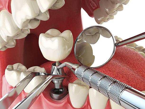 Best Pediatric Emergency Dentist in Mount Vernon, MD